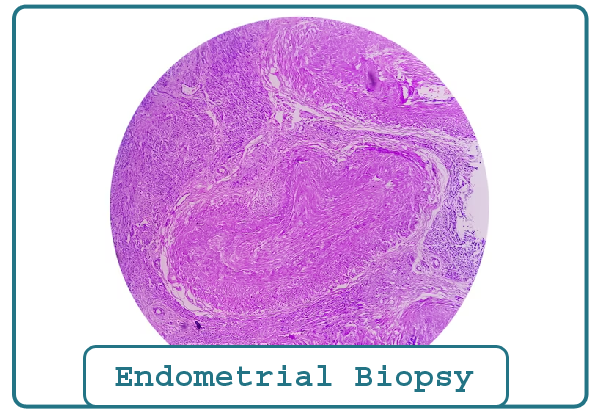 Endometrial Biopsy